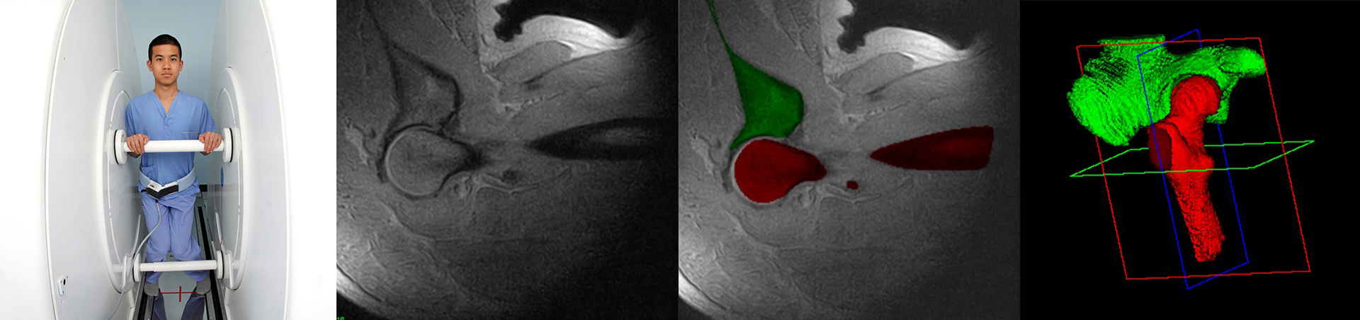 knee bent scan and images